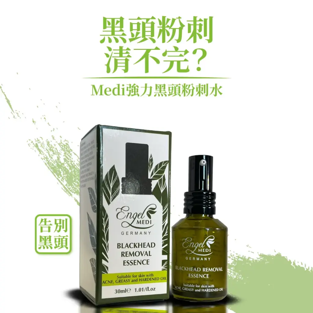 blackhead_prom_01.webp